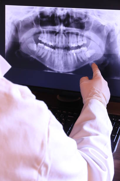 Best Chipped Tooth Repair Near Me  in Swift Trail Junction, AZ
